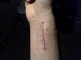 WickedScar.jpg Wicked Scar image by CommanderCyberDragon